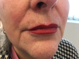 visage avec dermopigmentation des lèvres